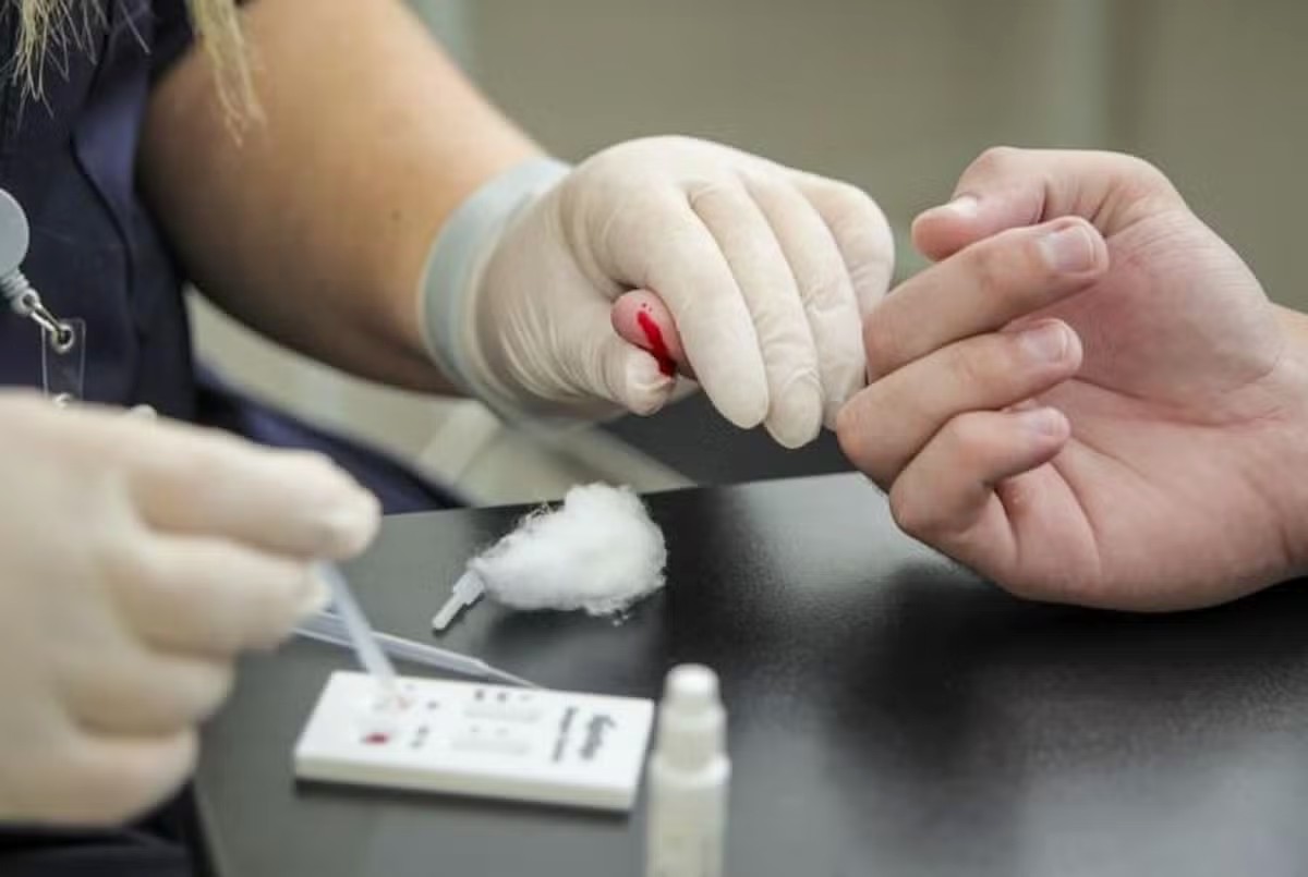Ceará vai receber 46,5 mil testes rápidos inéditos de dengue