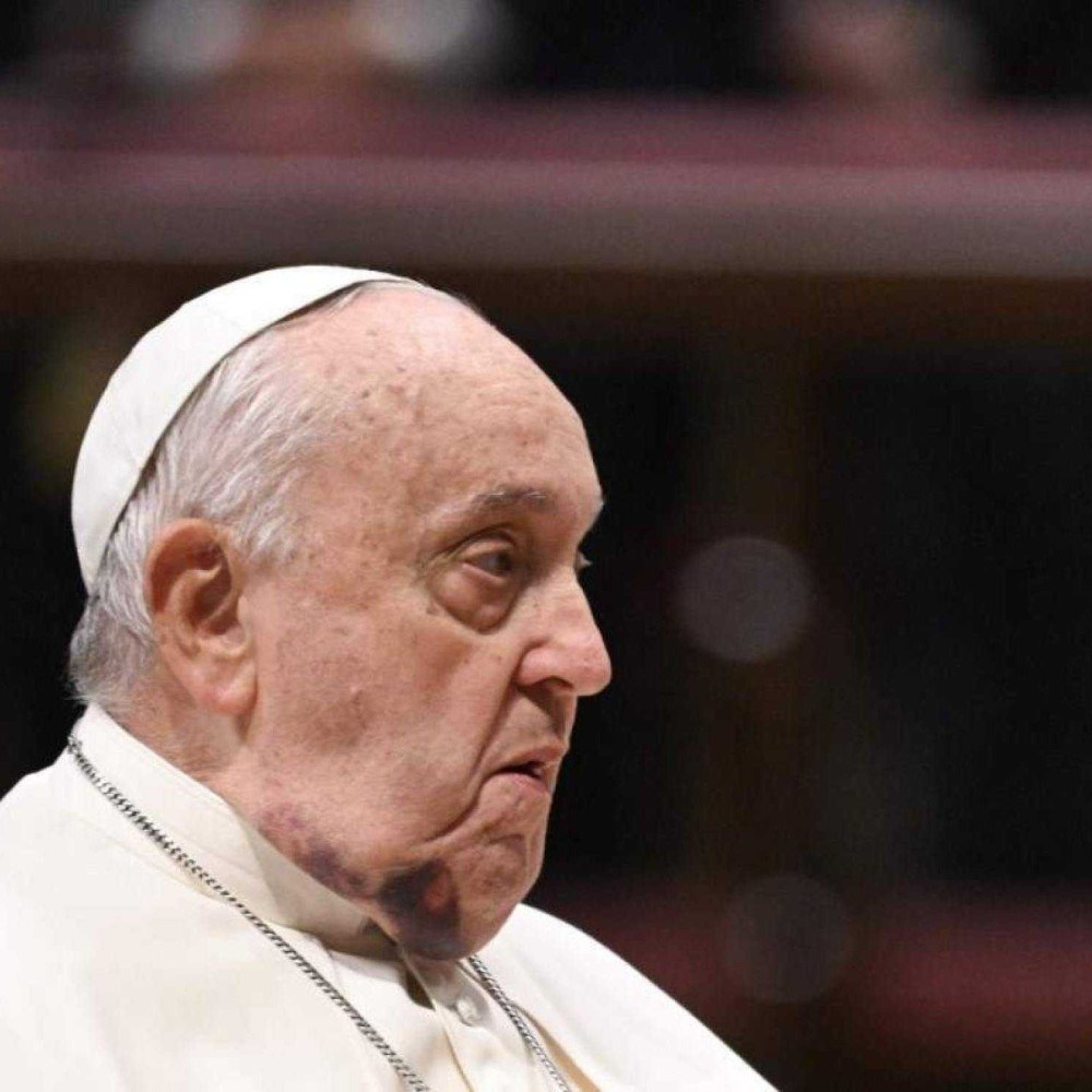 Papa Francisco tem dois episódios de insuficiência respiratória aguda