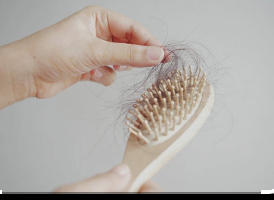 Queda de cabelo pode surgir após emagrecimento acelerado associado às canetas emagrecedoras