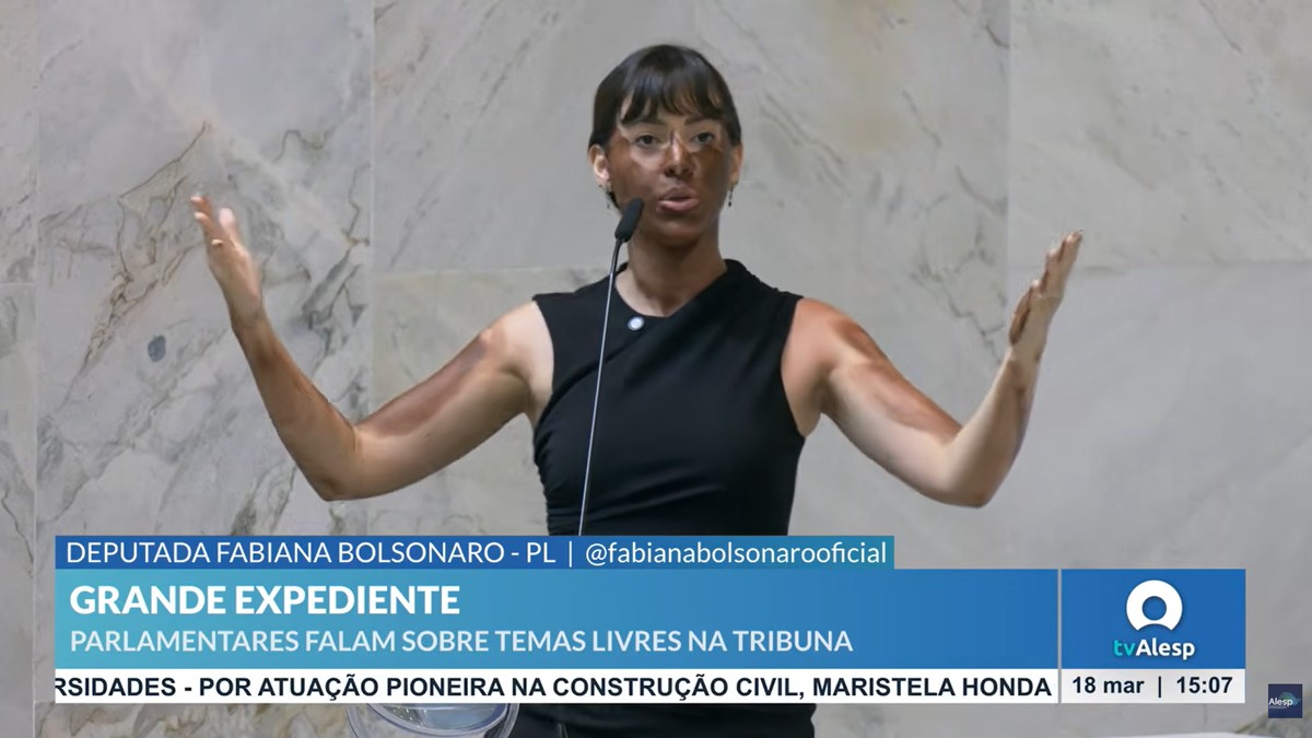 Deputada do PL faz ‘blackface’ em sessão da Alesp para criticar Érika Hilton | Política
