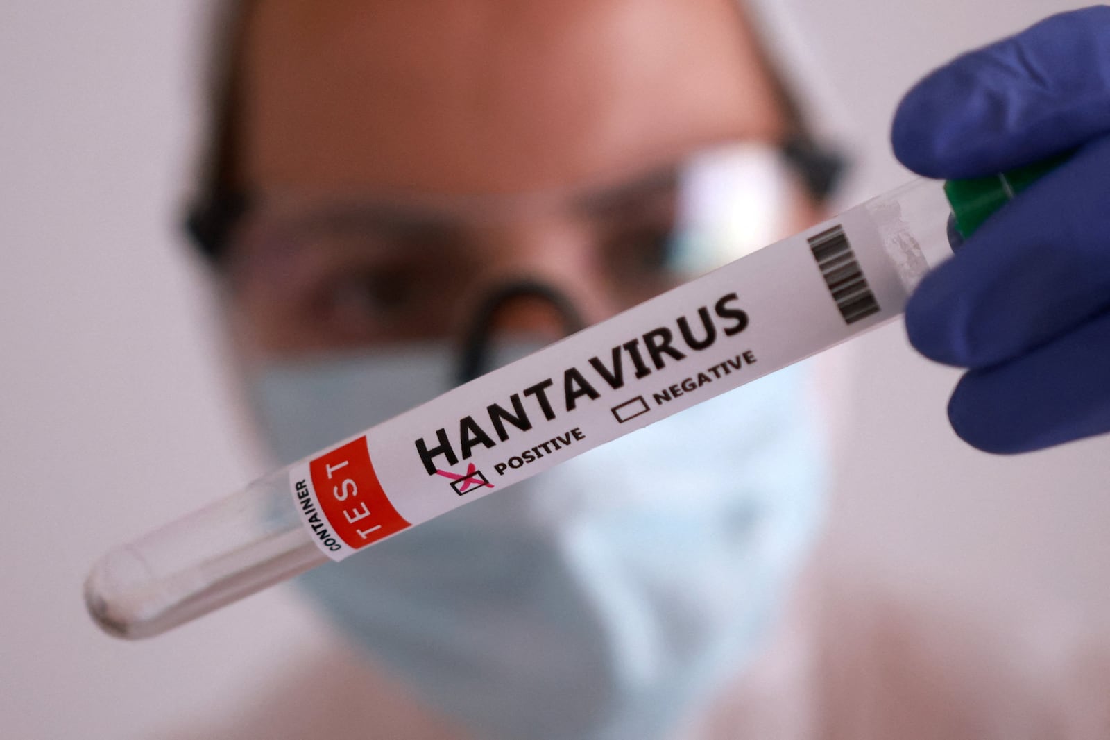Minas Gerais registra primeira morte por hantavírus em 2026