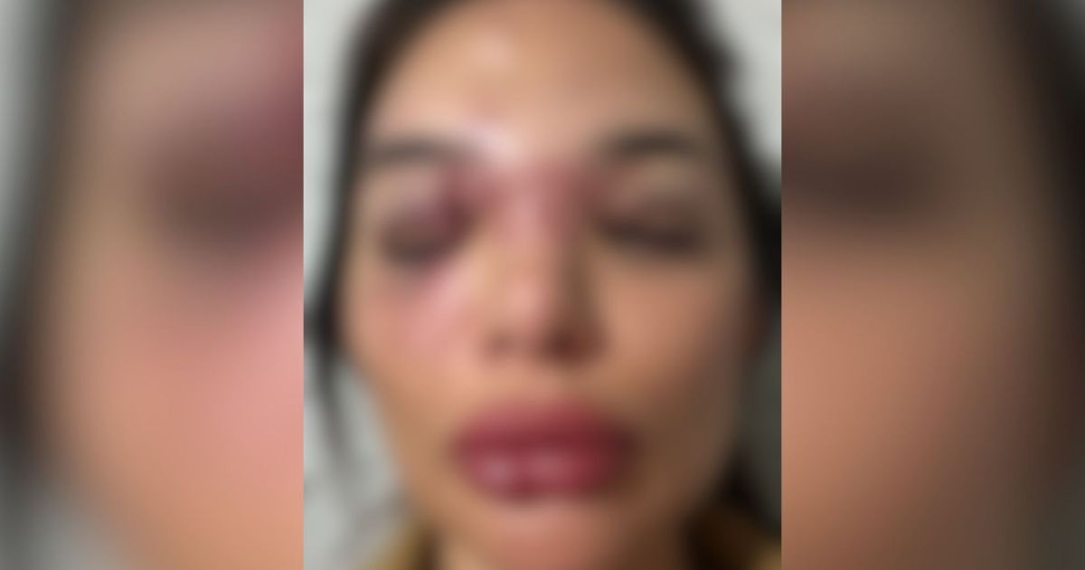 Veja depoimento de mulher agredida por empresário em São Paulo